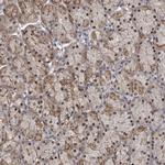 PRPF3 Antibody in Immunohistochemistry (IHC)