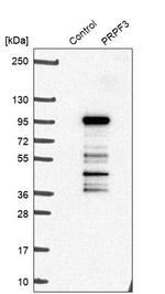 PRPF3 Antibody in Western Blot (WB)