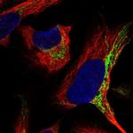 ADCK4 Polyclonal Antibody