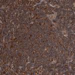 ADCK4 Antibody in Immunohistochemistry (Paraffin) (IHC (P))