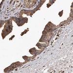 ADCK4 Antibody in Immunohistochemistry (Paraffin) (IHC (P))