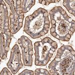 ADCK4 Antibody in Immunohistochemistry (Paraffin) (IHC (P))