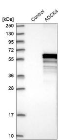 ADCK4 Antibody in Western Blot (WB)
