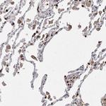 UBE3D Antibody in Immunohistochemistry (Paraffin) (IHC (P))