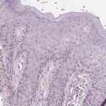 ERICH5 Polyclonal Antibody