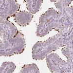 ERICH5 Antibody in Immunohistochemistry (IHC)