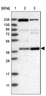 S100PBP Antibody in Western Blot (WB)