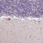 S100PBP Polyclonal Antibody