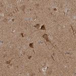 KIF21B Antibody in Immunohistochemistry (Paraffin) (IHC (P))