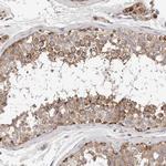 KIF21B Antibody in Immunohistochemistry (Paraffin) (IHC (P))