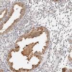GORAB Antibody in Immunohistochemistry (Paraffin) (IHC (P))