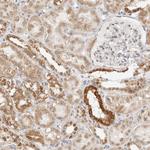 GORAB Antibody in Immunohistochemistry (Paraffin) (IHC (P))