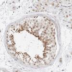 GORAB Antibody in Immunohistochemistry (Paraffin) (IHC (P))