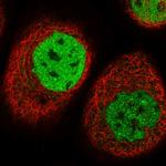 TESK2 Polyclonal Antibody