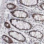 TESK2 Antibody in Immunohistochemistry (Paraffin) (IHC (P))