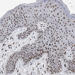 TESK2 Antibody in Immunohistochemistry (Paraffin) (IHC (P))