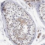TESK2 Antibody in Immunohistochemistry (Paraffin) (IHC (P))
