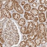 Lass2 Antibody in Immunohistochemistry (IHC)