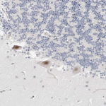 TSEN2 Antibody in Immunohistochemistry (Paraffin) (IHC (P))