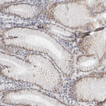TSEN2 Antibody in Immunohistochemistry (Paraffin) (IHC (P))