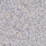 TSEN2 Antibody in Immunohistochemistry (Paraffin) (IHC (P))