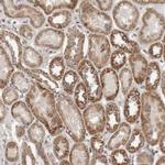 KIF21B Polyclonal Antibody