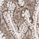 KIF21B Antibody in Immunohistochemistry (IHC)