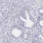 CCDC181 Antibody in Immunohistochemistry (IHC)