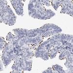 CCDC181 Antibody in Immunohistochemistry (IHC)