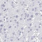 CCDC181 Antibody in Immunohistochemistry (IHC)