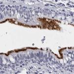 CCDC181 Antibody in Immunohistochemistry (IHC)