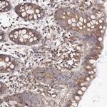 ADCK4 Antibody in Immunohistochemistry (Paraffin) (IHC (P))