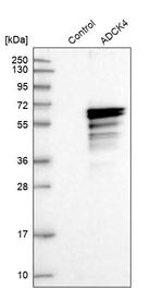 ADCK4 Antibody in Western Blot (WB)