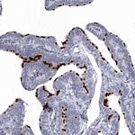 CCDC181 Polyclonal Antibody