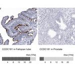 CCDC181 Antibody in Immunohistochemistry (IHC)