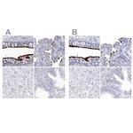 CCDC181 Antibody in Immunohistochemistry (IHC)