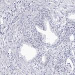 CCDC181 Antibody in Immunohistochemistry (IHC)