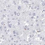 CCDC181 Antibody in Immunohistochemistry (IHC)