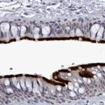 CCDC181 Antibody in Immunohistochemistry (IHC)