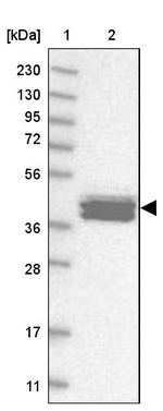 Calsequestrin 2 Antibody in Western Blot (WB)