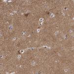 WDR47 Antibody in Immunohistochemistry (Paraffin) (IHC (P))