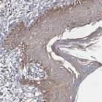 WDR47 Antibody in Immunohistochemistry (Paraffin) (IHC (P))