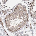 WDR47 Antibody in Immunohistochemistry (Paraffin) (IHC (P))
