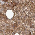 NUP43 Polyclonal Antibody