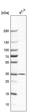 MDH1 Antibody in Western Blot (WB)