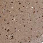 RAB3GAP2 Antibody in Immunohistochemistry (Paraffin) (IHC (P))