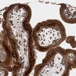 RAB3GAP2 Antibody in Immunohistochemistry (Paraffin) (IHC (P))