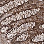 RAB3GAP2 Antibody in Immunohistochemistry (Paraffin) (IHC (P))