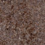 RAB3GAP2 Polyclonal Antibody