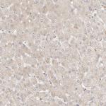 PABPC4 Antibody in Immunohistochemistry (Paraffin) (IHC (P))